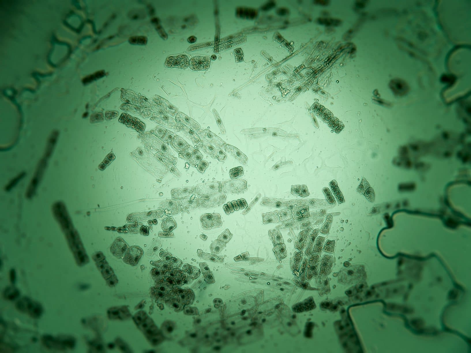 Microscopic diatoms in vivid green, representing cellular-level diagnostics